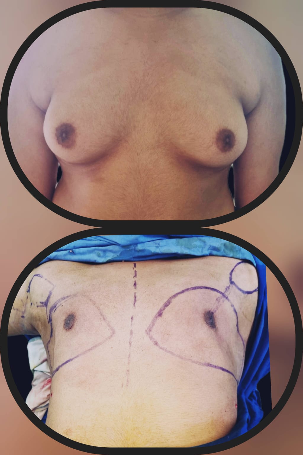 Before & After 33